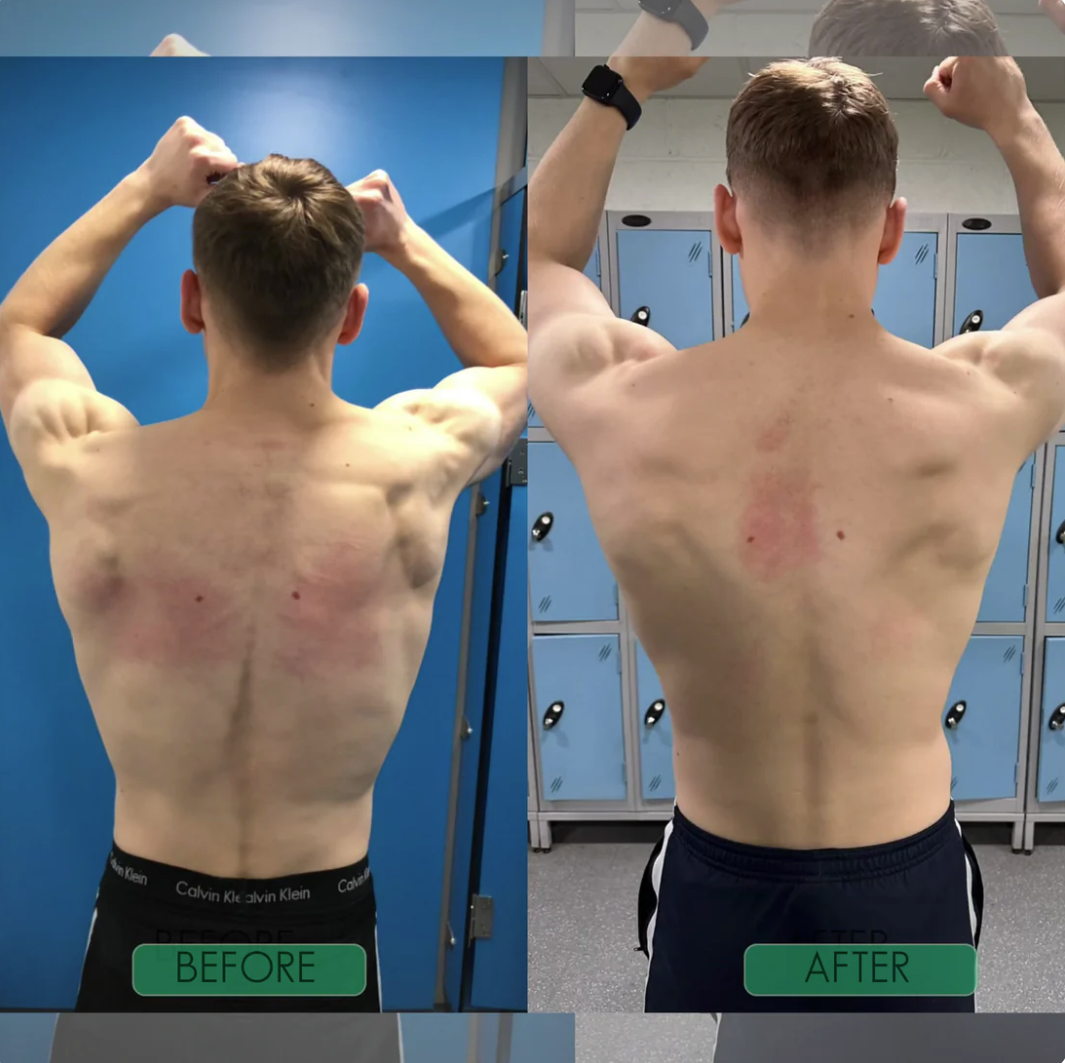 Instant Posture corrector 2.0